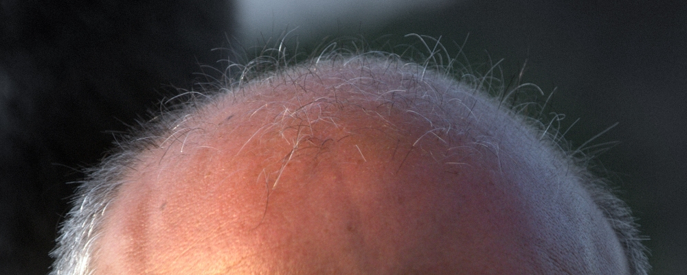 każdy włos jest policzony,zdjęcie: melehmann@flickr.com, CC-BY